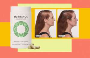 nutrafol reviews (1)